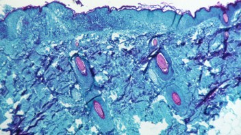 monkeypox virus under a microscope courtesy CDC